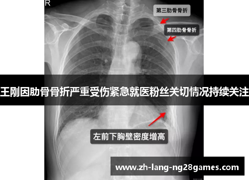 王刚因肋骨骨折严重受伤紧急就医粉丝关切情况持续关注 王刚因肋骨骨折严重受伤紧急就医粉丝关切情况持续关注